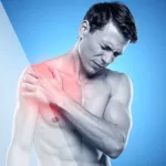 How Acupuncture Complements Sports Medicine: An Integrated Approach